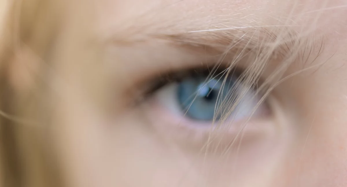 Zdrowie i uroda, skóra traci gładkość skąd bierze efekt „skórki pomarańczy” - zdjęcie, fotografia